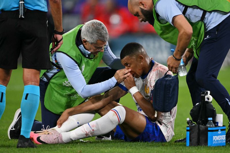 Prancis Harap-harap Cemas, Mbappe Patah Tulang Hidung